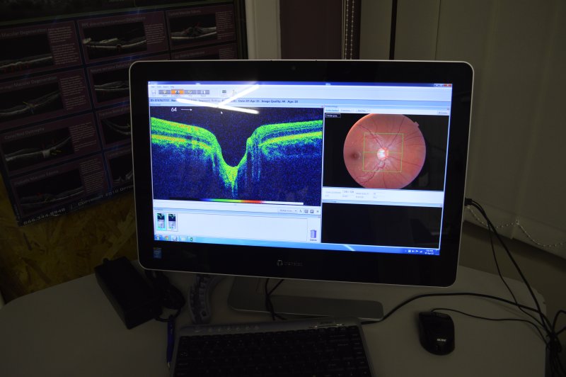 TRAT SI SCREENING GLAUCOM