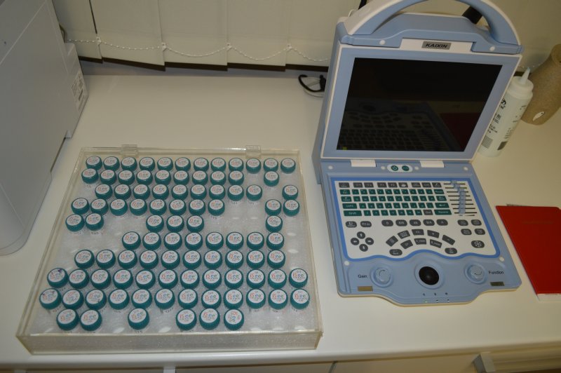 TRATAMENTUL MIOPIEI PROGRESIVE